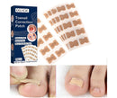 Adesivo TOENAIL™ - Desencrava Unhas e Elimina Micoses✅